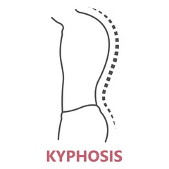 spine forward head posture chest xray neck pain lumbar Scheuermann's body discs brace sway back adam's spinal birth defect fracture cobb angle bone curved vertebrae cancer bend test exam kyphoplasty