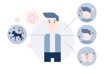 illustration of  monkeypox outbreak concept