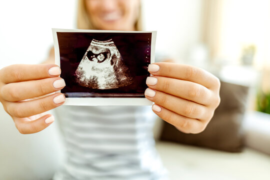 Close-up of pregnant belly and sonogram photo in hands of mother. Concept of pregnancy, gynecology, medical test, maternal health. Shot of a pregnant woman looking at a sonogram picture at home.