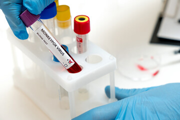 A medical worker in protective overalls holds a test tube with a sample of blood infected with monkeypox.Epidemic of monkeypox in Europe and the USA.Selective focus,close-up.