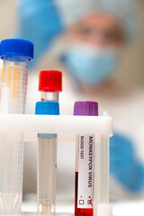 A test tube with a sample of blood infected with monkeypox, close-up.In the blurry background, a medic uses an automatic dispenser in the laboratory.Epidemic of monkeypox in Europe and the USA.