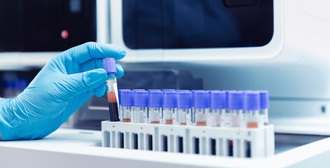 Banner medical blood tests on automatic modern equipment