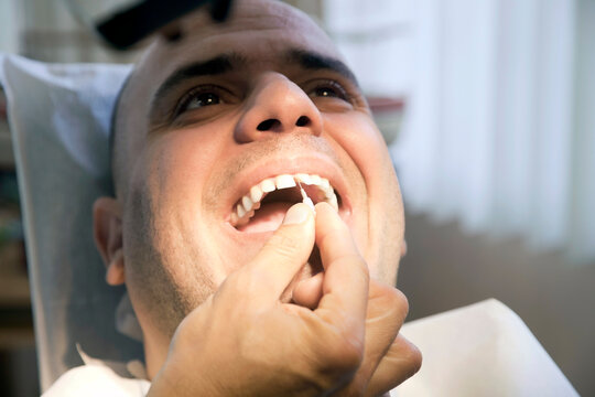 Dentist is Working On A Broken Teeth