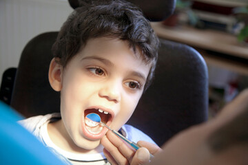 Dentist is Checking Details Of Little Boy's Teeth