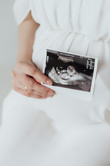 Pregnant woman holding ultrasound picture of baby in hand