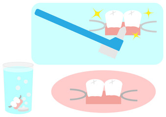 部分入れ歯のイラストセット