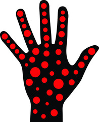Monkeypox virus hand outbreak pandemic awareness and alert icon against disease spread, symptoms or precautions. Vector Illustration.