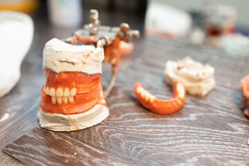 making dentures at the orthodontist	