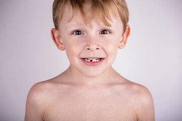 Loss of the first baby tooth in a child