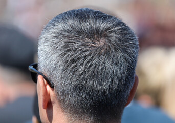 Gray hair on the head of a man.