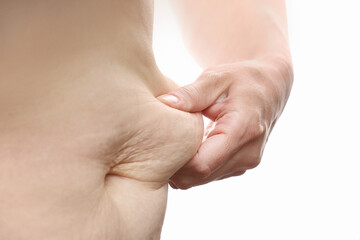 Close up of mother womans belly showing stretch mark loose lower abdomen skin she fat after...