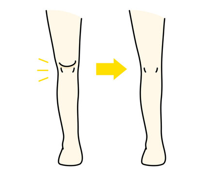 ビフォーアフター Images Browse 3 868 Stock Photos Vectors And Video Adobe Stock