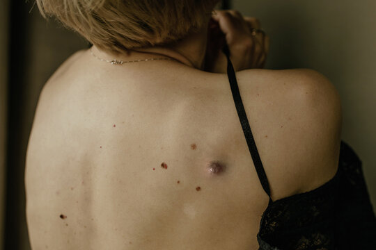 Beautiful woman with a bare back and moles is undressing and shy, close-up, details, indoors