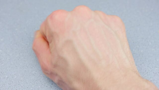 Veins on the hands of a man close-up. Bloating and dilatation of the veins of the limbs. Veins on the arm.
