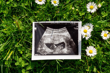 Ultrasound image pregnant baby photo. Ultrasound pregnancy picture on grass flowers background....