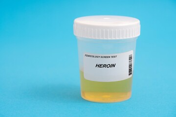 Heroin. Heroin toxicology screen urine tests for doping and drugs