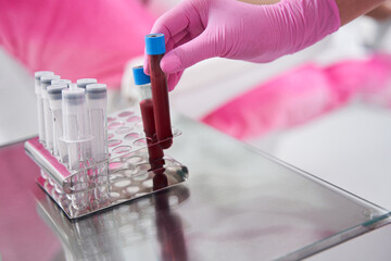 Hand in protective gloves places test tubes in special rack