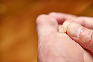 Tear off a piece of callus on the leg.