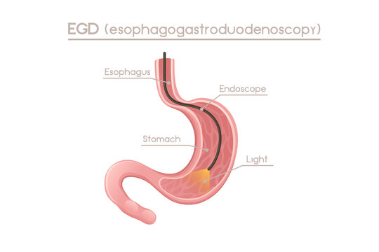 Human Stomach esophagogastroduodenoscopy cartoon design human anatomy organ vector illustration on white background