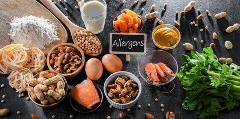 Composition with common food allergens - obrazy, fototapety, plakaty