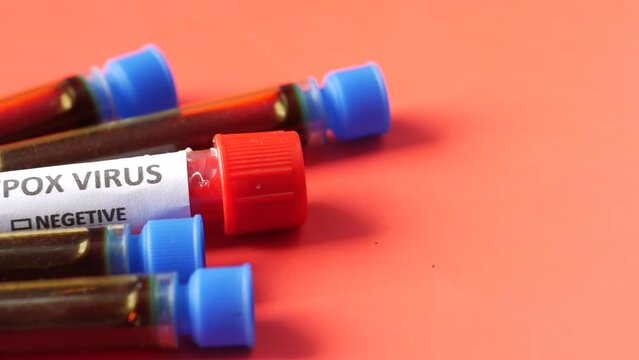monkeypox text on blood text tube on red background 