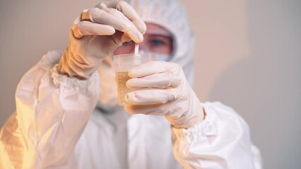 Laboratory in hospital. Doctor does test. Health worker opens container with biological material and wets test strip with litmus paper and waits for result and show this at camera. Glucose in urine.