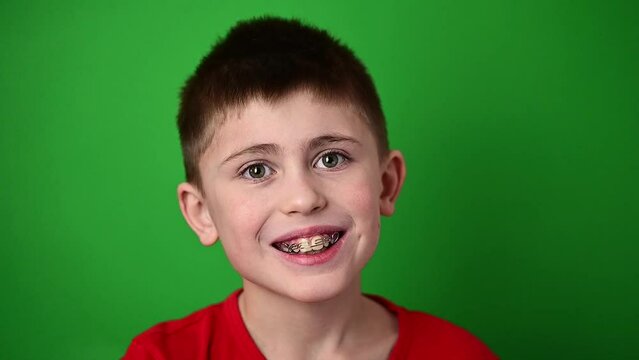 The boy is smiling, aligning his teeth with a dental plate, dental care.