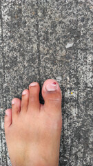 Abstract Defocused Injured and bleeding big toe on asphalt in Pangandaran, Indonesia