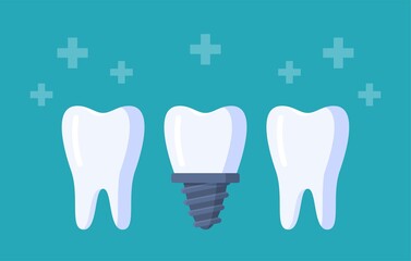 Vector illustration of tooth row. Three teeth isolated on a blue background. 