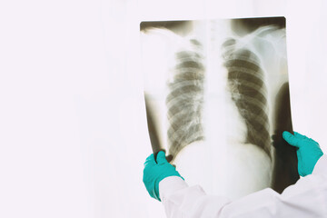 Doctor is examining x-ray film of lungs