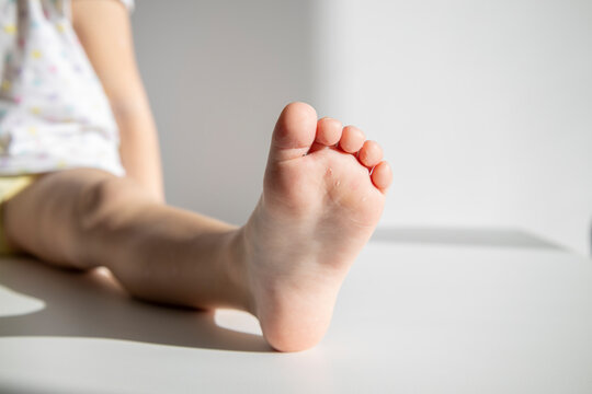 One child's foot on a white background. Child sitting on the floor.