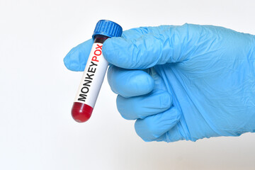 Naklejka premium Doctor holding Monkeypox virus infected blood in test tube. Monkeypox virus (MPXV) concept.
