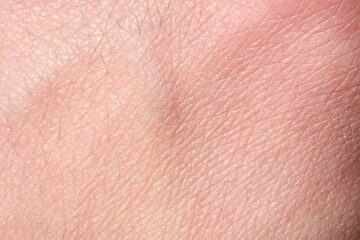 background of a pink skin texture. Healthy skin. Macro photo of skin cells.