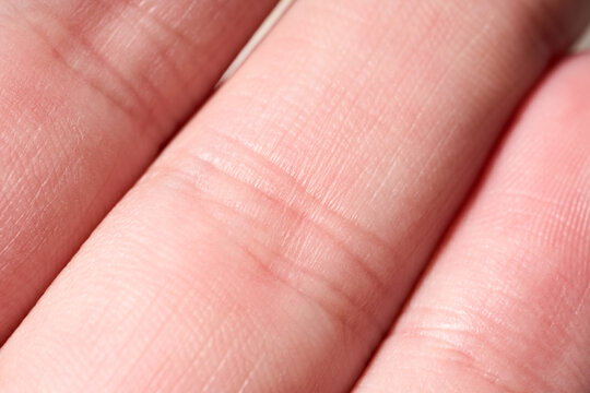 background of a pink skin texture. Healthy skin. Macro photo of skin cells.