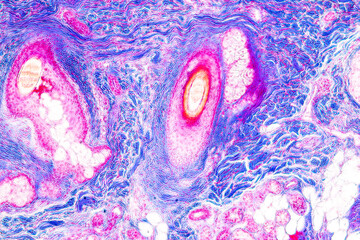 Scalp and hair follicles of human under the microscope in Lab.