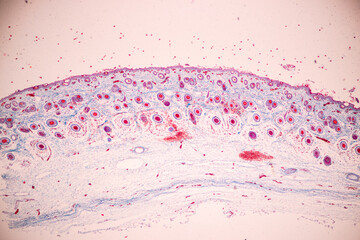 Scalp and hair follicles of human under the microscope in Lab.