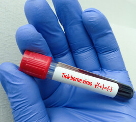 Blood sample for Tick borne virus test, Crimean Congo hemorrhagic fever(CCHF) virus test, Nairobi...