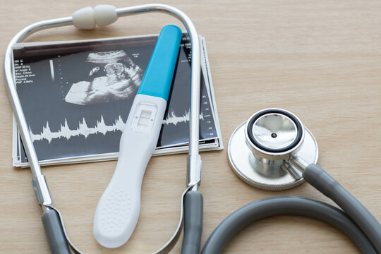 Pregnancy test showing a positive result and stethoscope, ultrasound picture of baby isolated on wooden background. Result of ultrasound picture, ultrasonography for pregnancy. Pregnancy care concept.