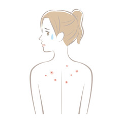 背中にニキビがある女性