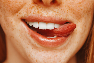 Close-up portrait of beautiful redhead young woman with freckles, leaking teeth with tongue.