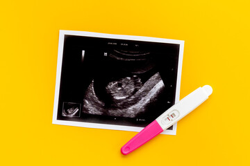Prenatal ultrasound screening of unborn baby. Pregnancy background