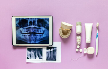 Dental care and timely treatment. Plain x-ray of all teeth and two pictures of diseased teeth, a cast of  jaw and oral care items: brush, paste, floss, prophylactic calcium tablets on pink background