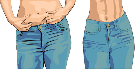 Before and after. Set women with fat belly. The girl clamps the fold of the belly with both hands.