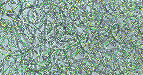 Nostoc sp. blue-green algae under microscopic view, cyanobacteria