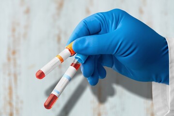 Blood sample for Genetic test, known as mutations,