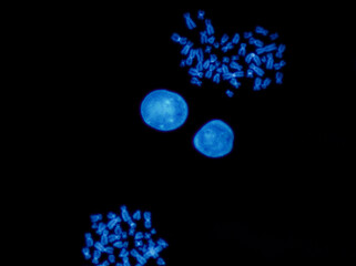 Chromosomes under fluorescence microscope, fluorescence in situ hybridization technique, Human...