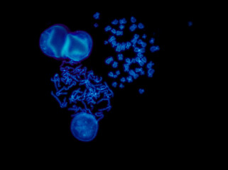 Fototapeta na wymiar Chromosomes under fluorescence microscope, fluorescence in situ hybridization technique, Human chromosomes from blood