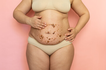 Cropped of overweight fat woman holding tummy, flabs with obesity, excess fat in underwear,...