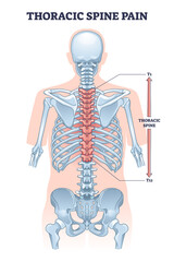 Thoracic spine pain as soft tissue muscle inflammation outline diagram. Labeled educational medical backbone skeletal trauma as painful problem vector illustration. Chronic vertebrae posture condition