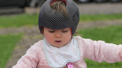 Baby girl wearing a cranial remoulding helmet flat head - obrazy, fototapety, plakaty